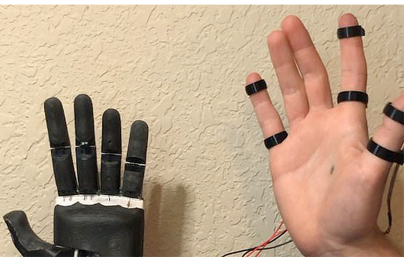 देशभरका चार सय २८ जनालाई निःशुल्क कृत्रिम हात वितरण गरिने