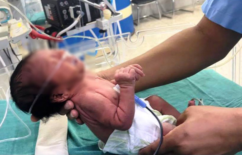 ‘समय नपुगी जन्मिएका शिशुको एक महिनाभित्र अनिवार्य परीक्षण गराउनुपर्ने’