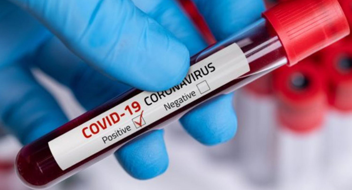 डोटीमा १२ स्वास्थ्यकर्मीमा कोरोना सङ्क्रमण