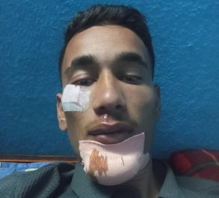 भक्तपुरको सानोठिमी क्याम्पसको स्ववियु अध्यक्ष ठगुन्नामाथि शनिवार राति कुटपिट