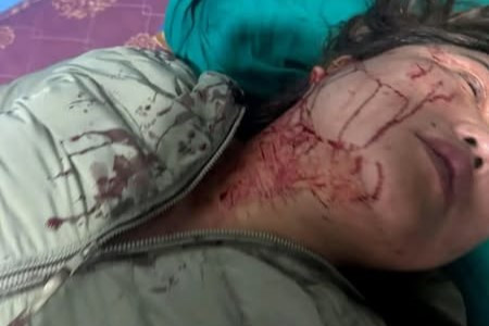 शर्मिला वाईबालाई पैसा दिन बोलाएर रडले हानेको भन्दैे रगताम्य फोटो भाइरल