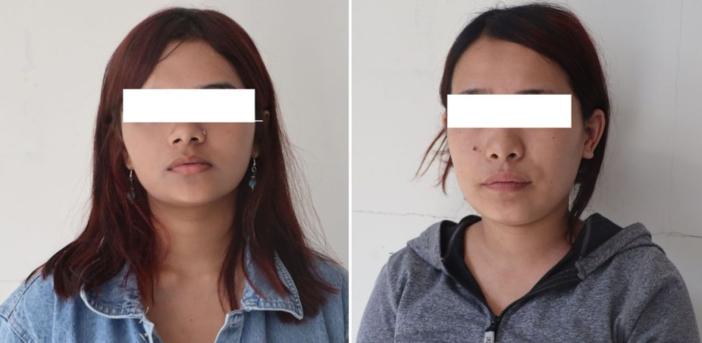 यी २ युवती, जसले युवकलाई होटलको ४०२ नम्बर कोठामा लगेपछि...