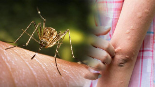 जापानिज इन्सेफलाइटिसबाट १०३ सङ्क्रमति