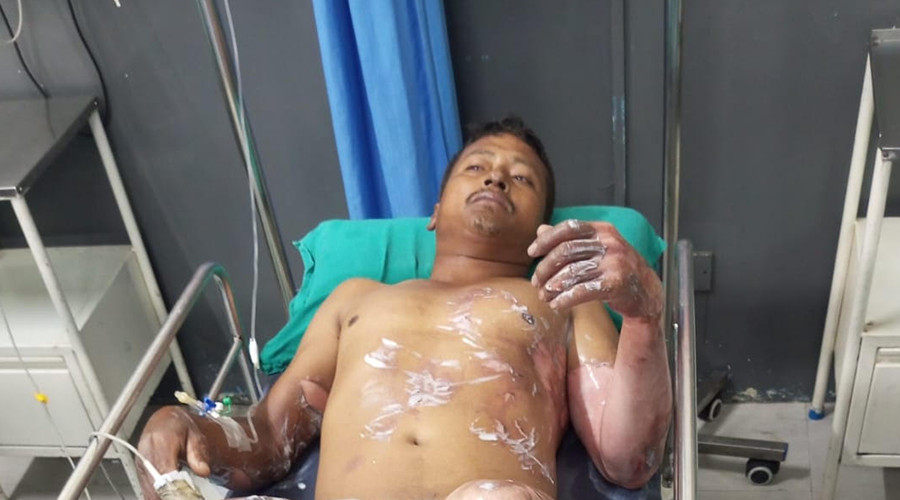 मकवानपुरमा आगलागीबाट २ करोडको  भन्दा बढिको क्षति, आगो निभाउने क्रममा घरधनी घाइते