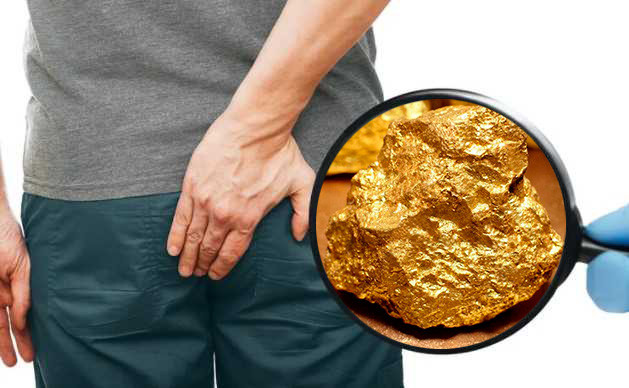 मलद्वारमा फेला पर्‍यो पहेलो धातु, भारतीय नागरिक पक्राउ