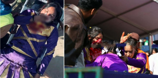 एनपीएल २:  छक्का हानेको बलले लागेर चियर लिडर घाइते