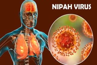 निपाह भाइरस फैलिन नदिन उच्च शतर्कता, भारतसँग जाेडिएका पश्चिमी सबै नाकामा कडा निगरानी