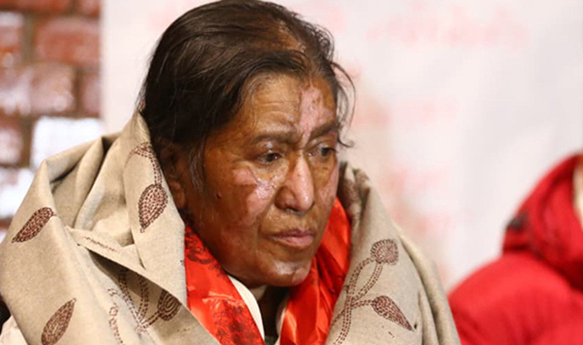 तीन महिनाको उपचारपछि फर्किइन् झलनाथ पत्नी, भन्छिन्– ग्यास च्याम्बरमा हालेजस्तै जलाएर मार्न खोजियो